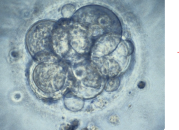 human embryo for ivf